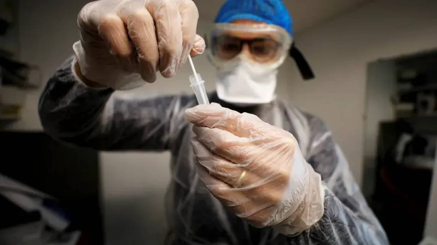 Plafonnement des prix des tests PCR : les laboratoires demandent une baisse des coût des réactifs